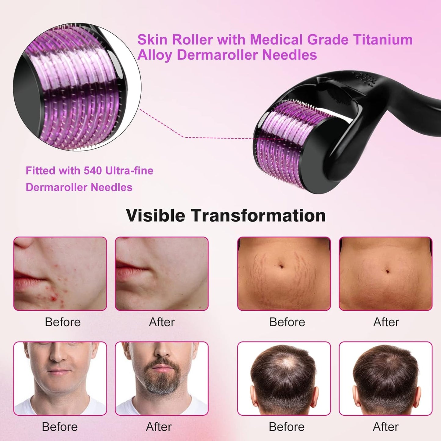 Derma Roller | Needles 0.5mm | 540 Titanium Micro Needles for Face | Beard Hair Growth and Scars Facial Roller Derma Rolling Skin Roller for Home Use